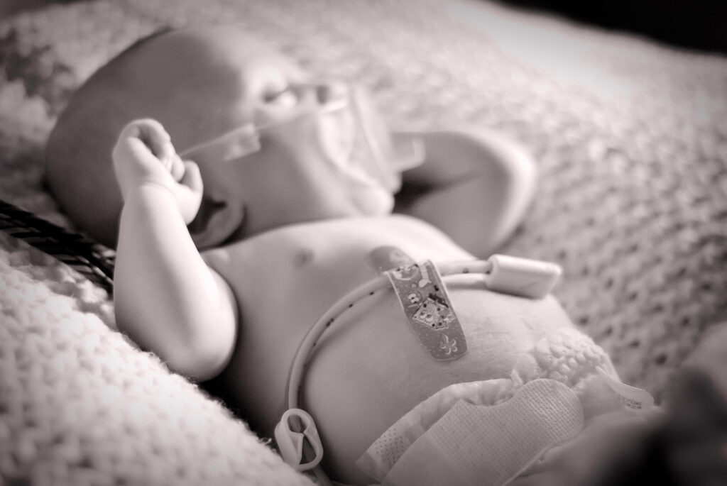 Premature twin newborns photographed in studio, one with oxygen tube and feeding tube, Twin Cities newborn photographer